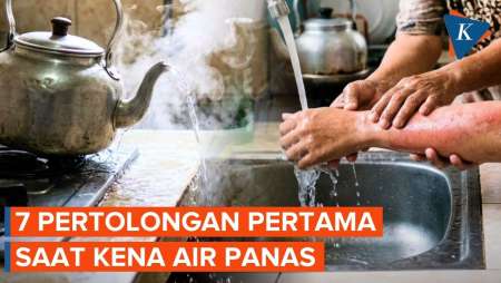 Pertolongan Pertama Kena Air Panas