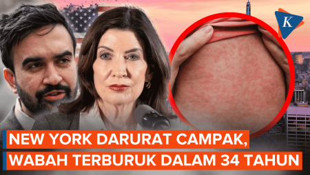 New York AS Tetapkan Darurat Campak, Wabah Terburuk dalam 34 Tahun
