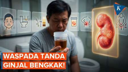 Tanda-tanda Ginjal Bengkak Yang Harus Diwaspadai