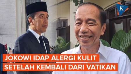 Jokowi Alami Alergi Kulit Setelah Pulang dari Vatikan