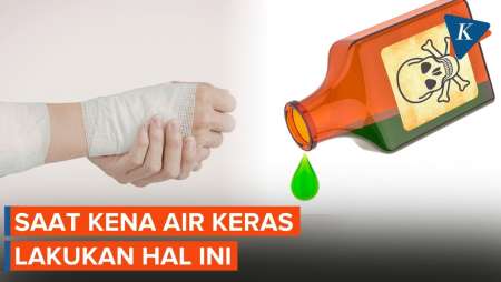 Pertolongan Pertama Saat Tersiram Air Keras