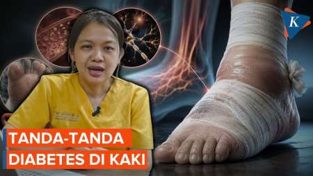 Cara Rawat Luka Pada Penderita Diabetes
