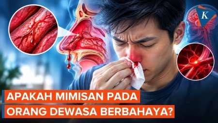 Apakah Mimisan Berbahaya?
