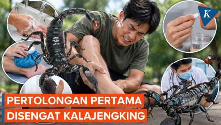 Pertolongan Pertama Saat Disengat Kalajengking