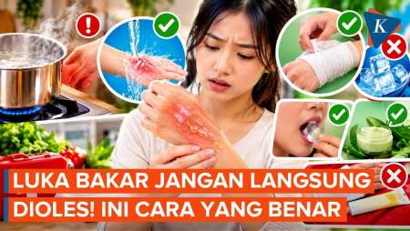 Pertolongan Pertama Saat Terkena Luka Bakar