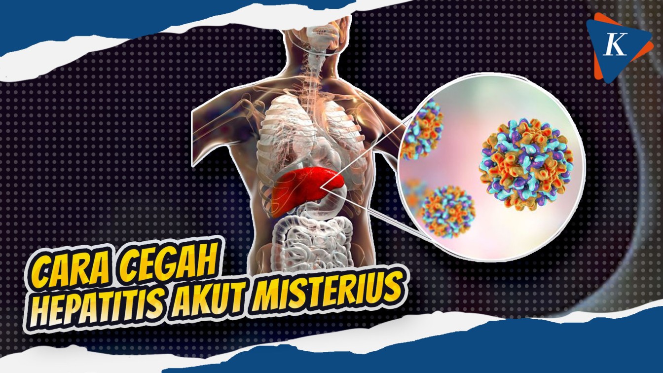Kasus Hepatitis Akut Terdeteksi di Indonesia, Ini Gejala hingga Pencegahannya