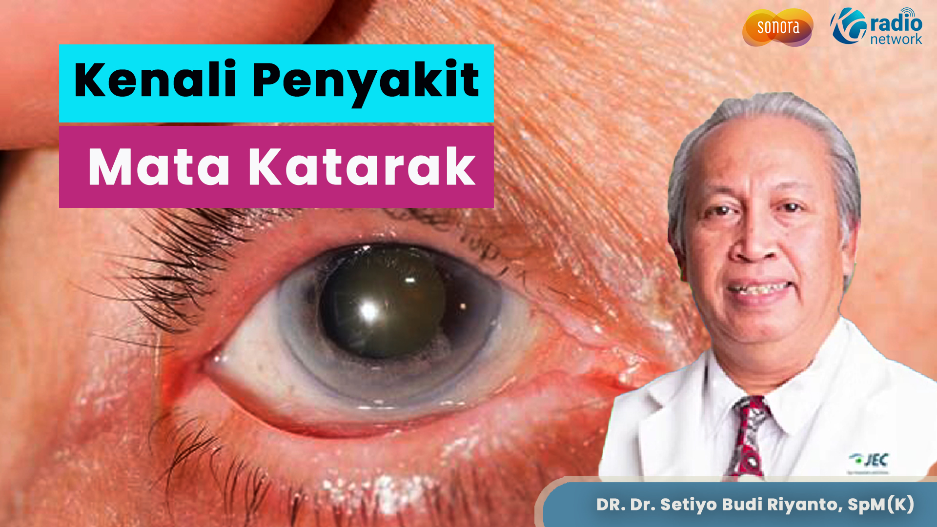 Mengenal Penyakit Mata Katarak | JEC Eye Hospitals and Clinics