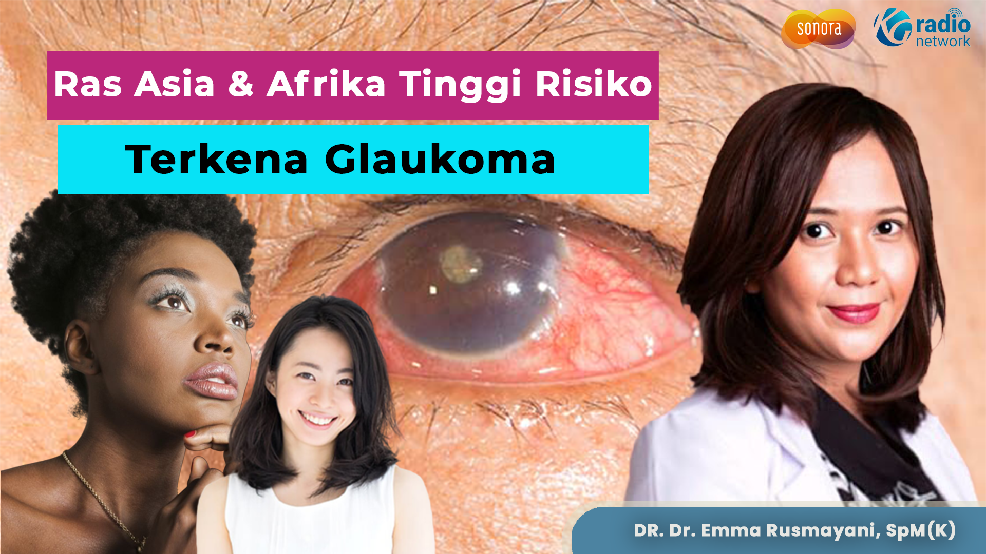 Faktor Risiko Terkena Glaukoma | Talkshow Kesehatan Sonora-JEC Eye Hospitals & Clinics