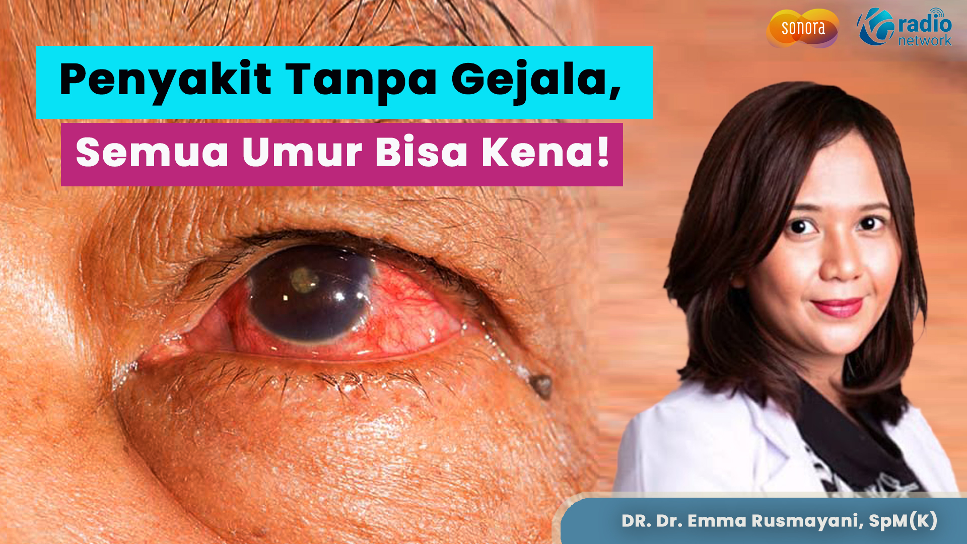 Mengenal Penyakit Mata Glaukoma | Talkshow Kesehatan Sonora-JEC Eye Hospitals & Clinics